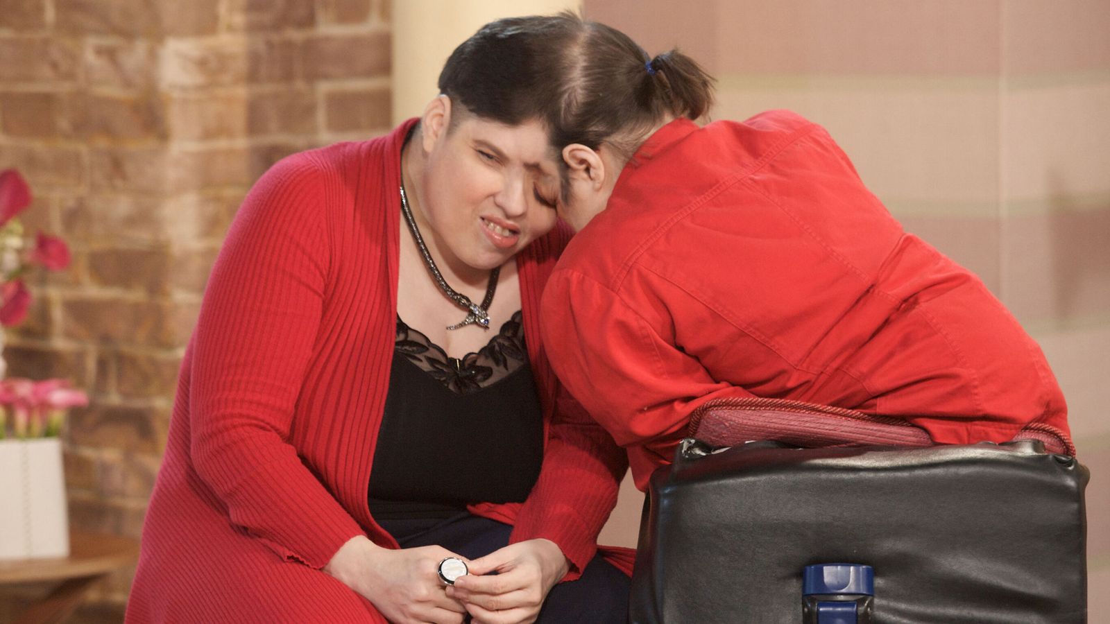 Cei mai în vârstă siamezi din lume, Lori și George Schappell, au murit la 62 de ani