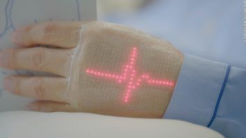 A fost inventată pielea electronică. E-skin imită finețea pielii umane