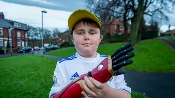 Un băiețel de 5 ani primește un braț bionic marca Iron Man