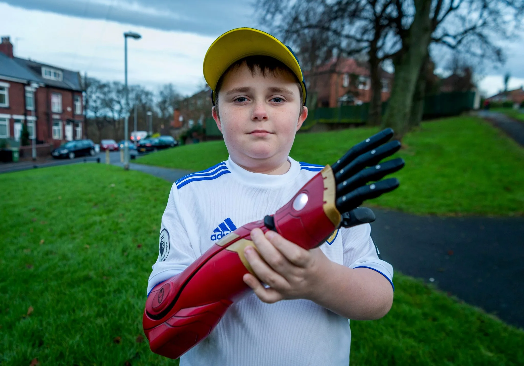 Un băiețel de 5 ani primește un braț bionic marca Iron Man