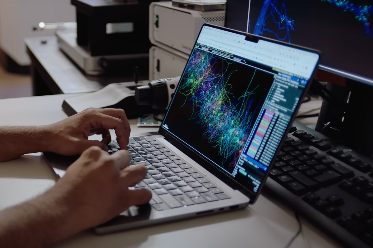 Google și Harvard mapează creierul folosind  tehonologia A.I. Care sunt obiectivele proiectului