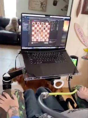 Noland Arbaugh, prima persoană cu un implant cerebral dezvoltat de Elon Musk poate opera un computer cu puterea minții