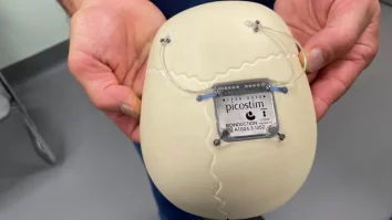 Primul dispozitiv pentru epilepsie din lume a fost montat în craniul unui băiat din Marea Britanie. Cum se simte Oran Knowlson