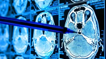 O nouă tehnologie bazată pe A.I. poate ajuta la detectarea timpurie a cancerului. Ce au descoperit cercetătorii