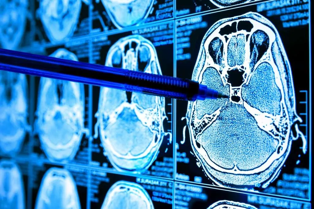 O nouă tehnologie bazată pe A.I. poate ajuta la detectarea timpurie a cancerului. Ce au descoperit cercetătorii