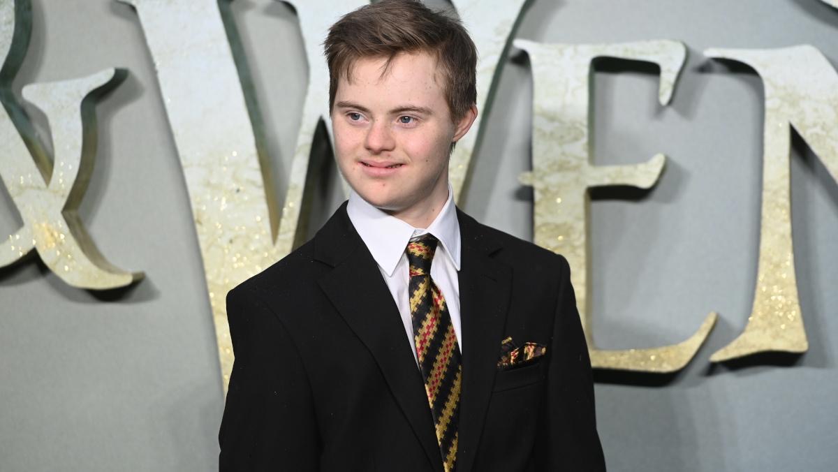 Pelicula Peter Pan & Wendy are primul actor cu sindrom Down într-un rol principal. Cine este Noah Matthews