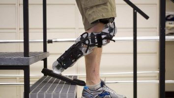 Cercetătorii de la MIT au creat proteza bionică pentru picior. Cum funcționează aceasta