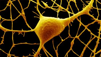 Autismul ar putea fi depistat printr-un test simplu. Ce au descoperit cercetătorii