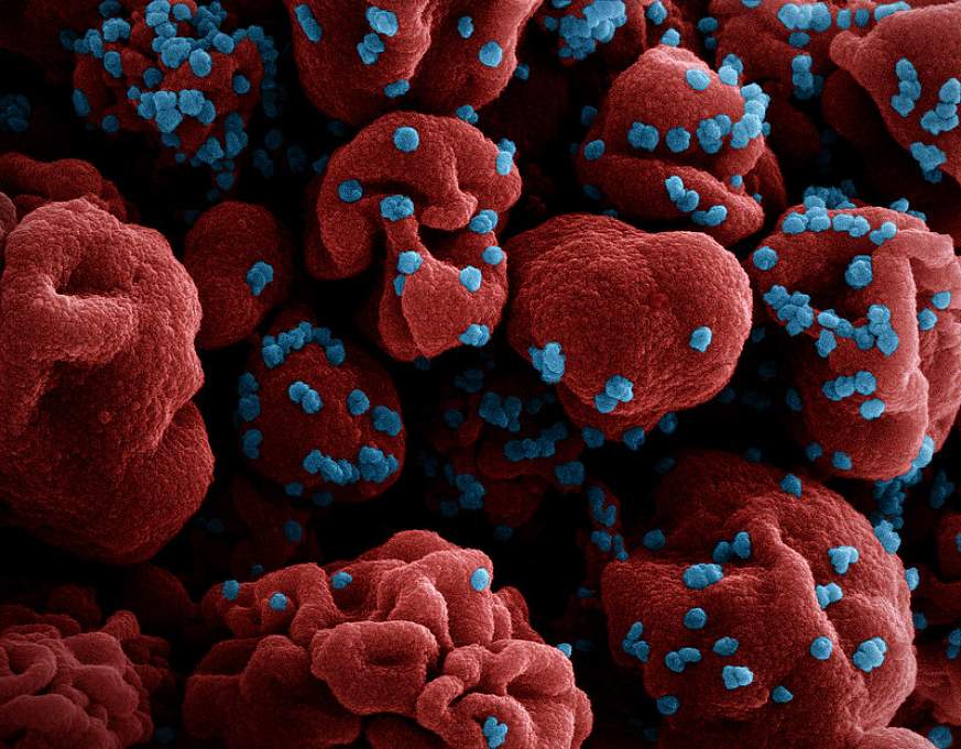 Există o creștere semnificativă a cazurilor de infecție cu SARS-CoV-2. Adrian Marinescu: „În ultimele 2-3 săptămâni, am observat o curbă ascendentă”