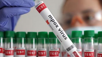 Cazurile noii variante de Mpox continuă să se răspândească. Țările asiatice sporesc controalele la frontiere