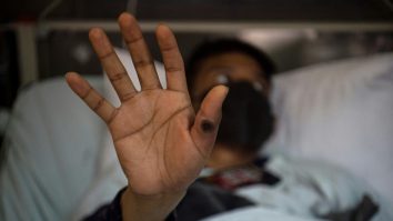 Cât de pregătiți suntem pentru o nouă pandemie? Eșecul de a sprijini țările africane afectate de Mpox riscă să pună lumea în pericol