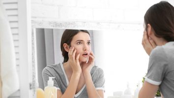 „Sunburning” e noul trend pe TikTok care ar putea vindeca acneea. Medic dermatolog: „Persoanele tinere care se expun la soare riscă să dezvolte un cancer de piele la vârsta adultă”