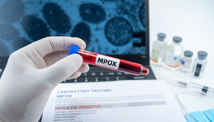 Marea Britanie comandă 150.000 de doze de vaccin anti-Mpox din cauza răspândirii unei noi tulpini în Africa