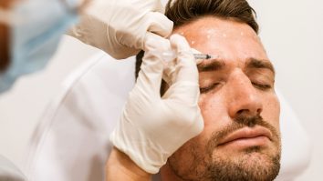 Nu botox, ci „Brotox” este noul trend pentru bărbați. Tot mai multe vedete apelează la intervenția cosmetică