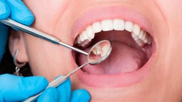 Stomatologia e la mare căutare în România. Numărul de medici stomato­logi a ajuns la 21.200 în 2023