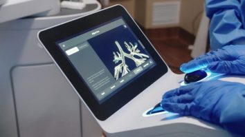 Sistemul Ion revoluționează medicina. O nouă sondă robotică îi ajută pe medici să diagnosticheze mai rapid cancerul pulmonar