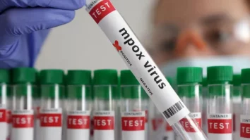 OMS aprobă primul test de mpox pentru diagnosticarea rapidă. 635 de persoane au murit în acest an