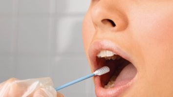 Un nou test de salivă poate determina cât mai ai de trăit