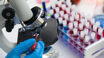 Cercetătorii britanici au creat un cip care detectează celulele canceroase. Anul trecut, peste 38.000 de români au murit din cauza cancerului