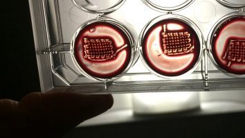 Oasele vor fi imprimate 3D din sângele pacientului