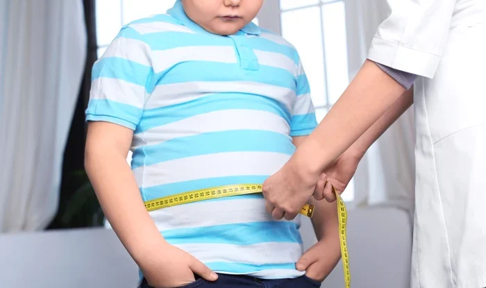 Obezitatea afectează unul din cinci copii români. Ce recomandări au specialiștii pentru a preveni bolile cronice