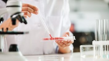 NHS studiază un nou test de sânge care are potențialul de a revoluționa diagnosticarea demenței. Când va fi disponibil pe piață