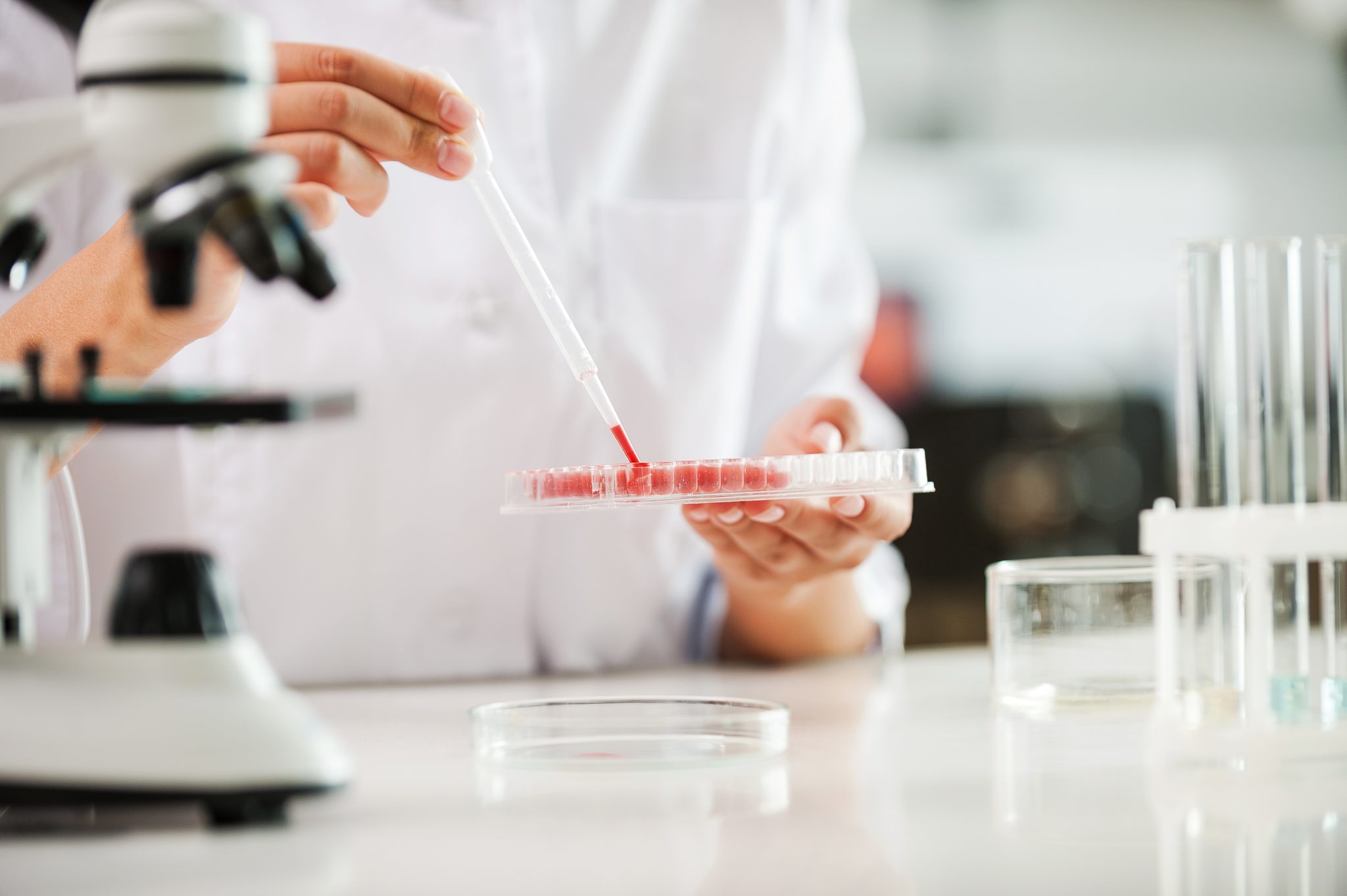 NHS studiază un nou test de sânge care are potențialul de a revoluționa diagnosticarea demenței. Când va fi disponibil pe piață