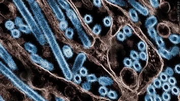 SUA au înregistrat primul deces cauzat de gripa aviară. Pacientul era din Louisiana