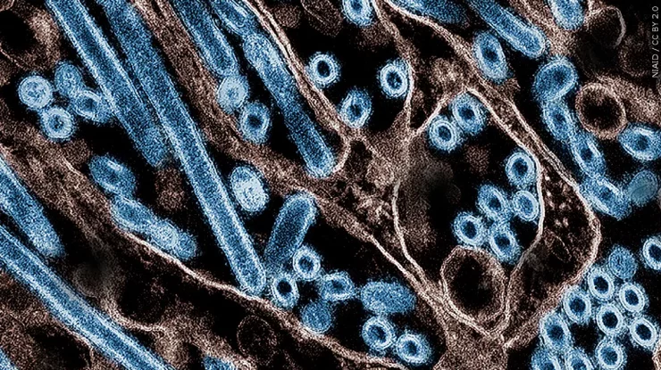 SUA au înregistrat primul deces cauzat de gripa aviară. Pacientul era din Louisiana