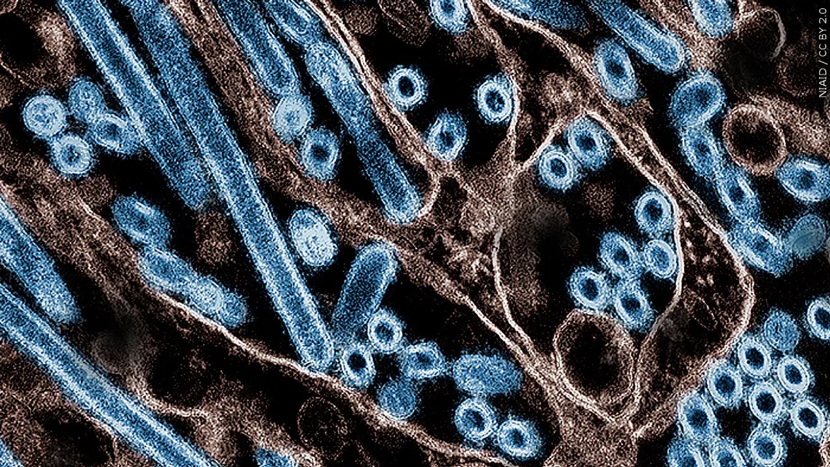 SUA au înregistrat primul deces cauzat de gripa aviară. Pacientul era din Louisiana