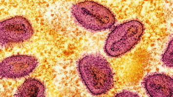 Un nou caz de Mpox a fost confirmat în Anglia: „Riscul rămâne scăzut”