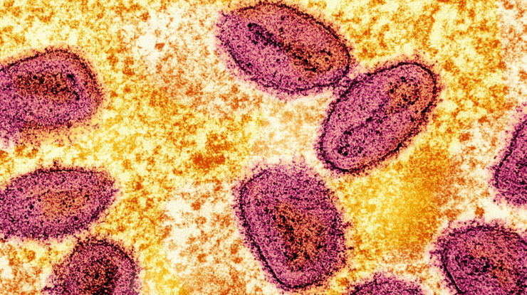 Un nou caz de Mpox a fost confirmat în Anglia: „Riscul rămâne scăzut”