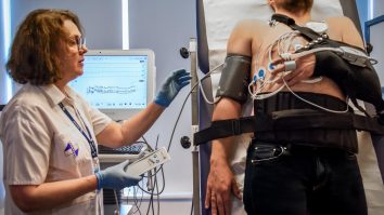 Primul laborator complet pentru evaluarea sincopei din sistemul medical privat din România