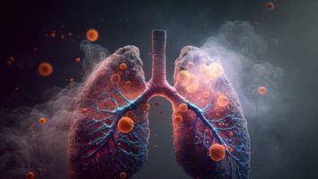 Tot mai mulți nefumători fac cancer pulmonar. Ce spune OMS