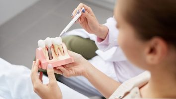 Medicina evoluează. Cum sunt revoluționate implanturile dentare