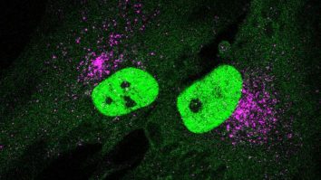 Cercetătorii au găsit o nouă metodă care ar putea încetini procesul de îmbătrânire. Cât de aproape suntem de un tratament real