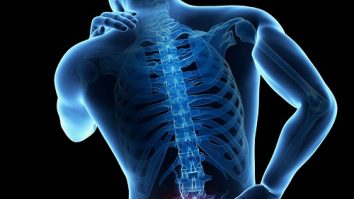 Durerile lombare afectează milioane de oameni. Care este singurul tratament care își face efectul