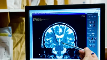 Gândurile prind glas: Tehnologia care permite supraviețuitorilor de AVC să vorbească​