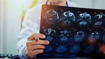 România are cea mai mare rată de mortalitate prin AVC din Europa. George Iana, Fondator SNRIR: „Pacientul trebuie să ajungă în 4-6 ore într-un centru specializat”