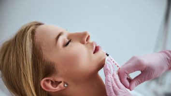Bărbații preferă femeile cu buze naturale, în detrimentul injectării cu botox, arată Sydney University. Cât va crește piața de fillere