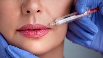 Universitatea din Sydney confirmă: bărbații iubesc buzele naturale