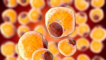 Grăsimea este direct legată de anxietate, dezvăluie un nou studiu inovator