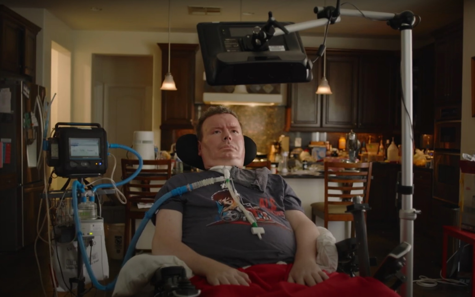 Un pacient cu cip Neuralink a postat un clip pe YouTube. Brad s-a gândit la mișcările limbii ca să mute cursorul pe ecran