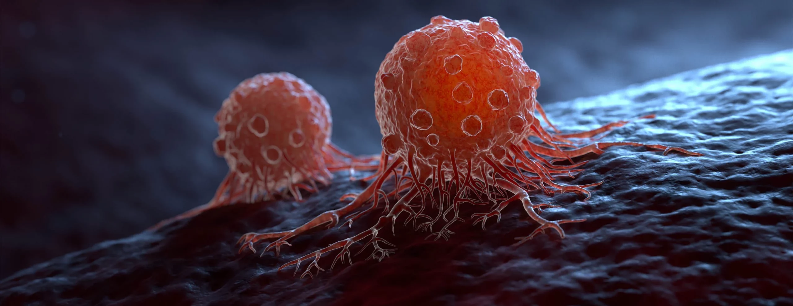 Un nou tratament revoluționar cu anticorpi face cancerul să dispară complet în 84 de pacienți