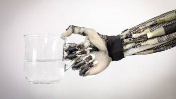 Primul braț bionic cu mușchi umani vii a fost creat în Spania