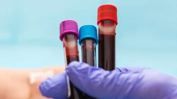 Vrei să afli ce vârstă are creierul sau ficatul tău? Un nou test de sânge bazat pe proteomica analizează aceste aspecte