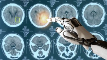 Inteligența Artificială detectează 170 de tipuri de cancer. Ce este modelul crossNN