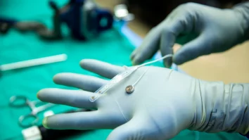 Elon Musk are competiție: Un nou implant cerebral al Paradomics poate reda vocea persoanelor paralizate