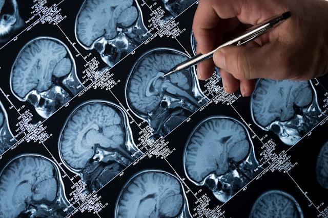 Curiozitatea reduce riscul de demență și de Alzheimer. Ce arată datele unui nou un studiu UCLA