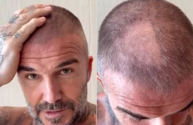 David Beckham a vrut să-și surprindă fanii cu un nou look, dar s-a ales cu o porțiune cheală în cap. Cum a reacționat soția sa
